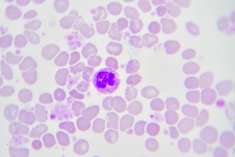 تحليل neutrophils