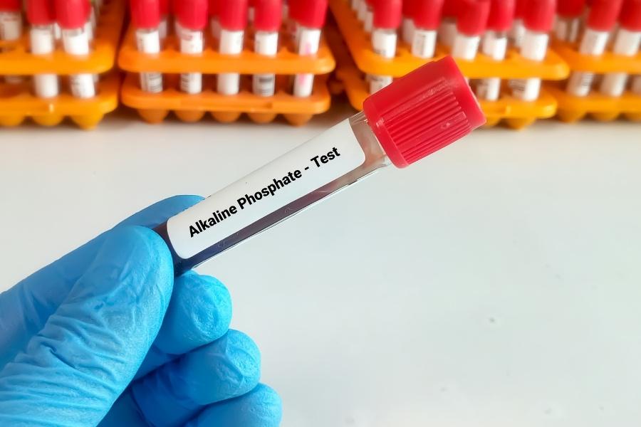 تحليل alkaline phosphatase