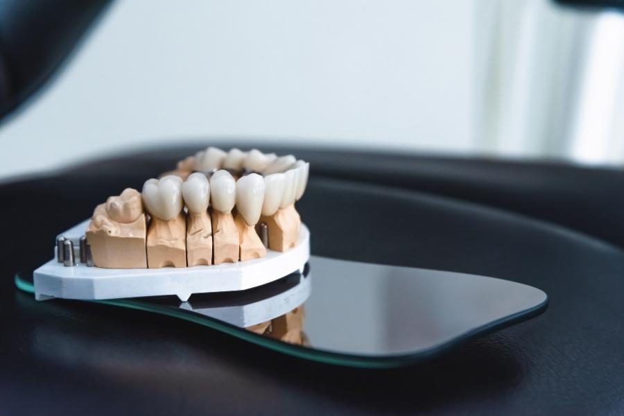 تركيبات الزيركون ابتسامة هوليود 3d